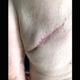 Image for article titled Bada Bing, Dr. Pimple Popper Meets Bada Boob